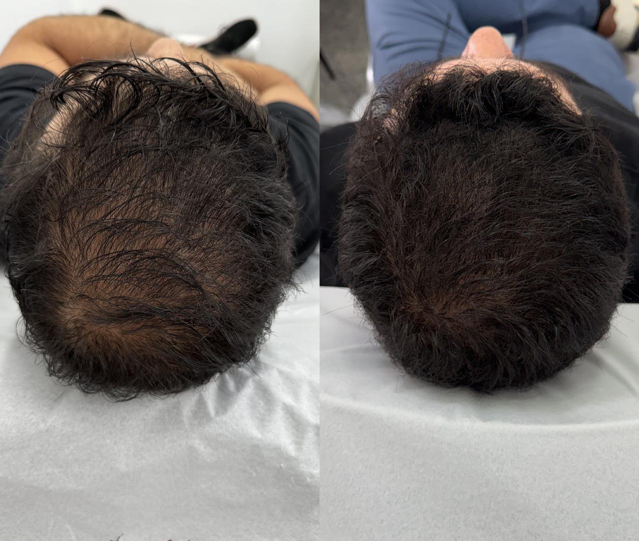 Antes e Depois 1