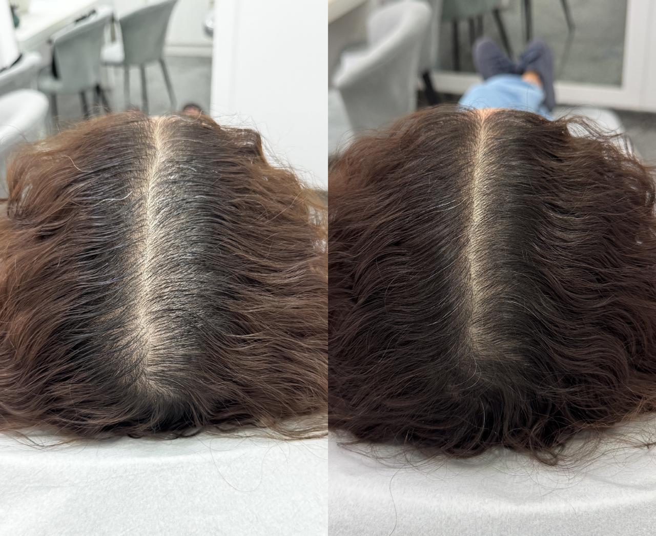 Antes e Depois 2