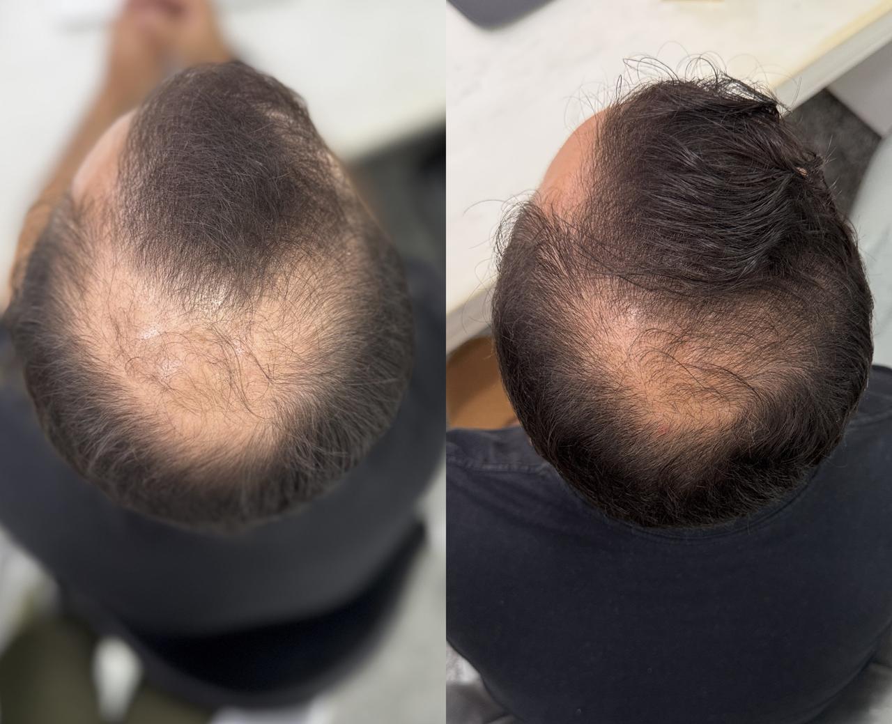 Antes e Depois 3