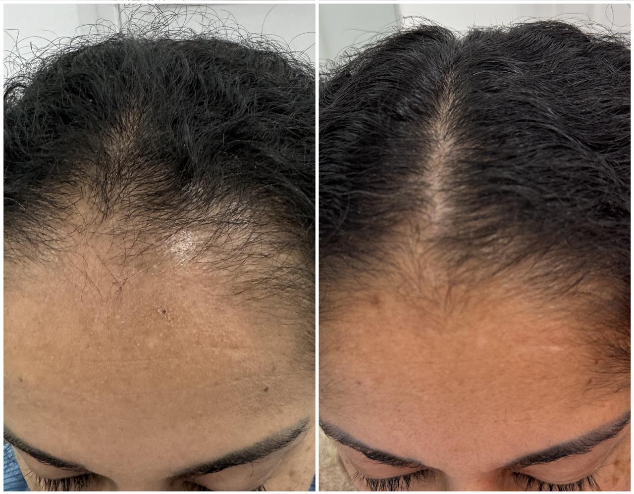 Antes e Depois 4