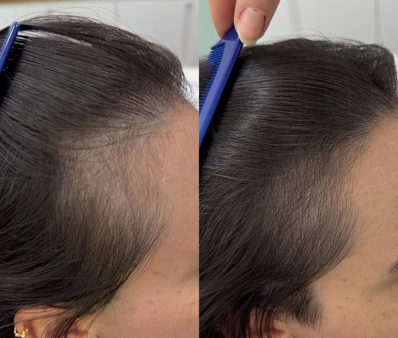 Antes e Depois 5