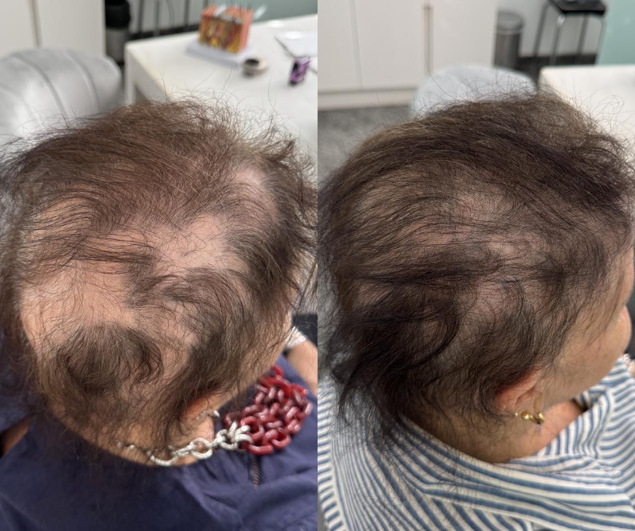 Antes e Depois 6