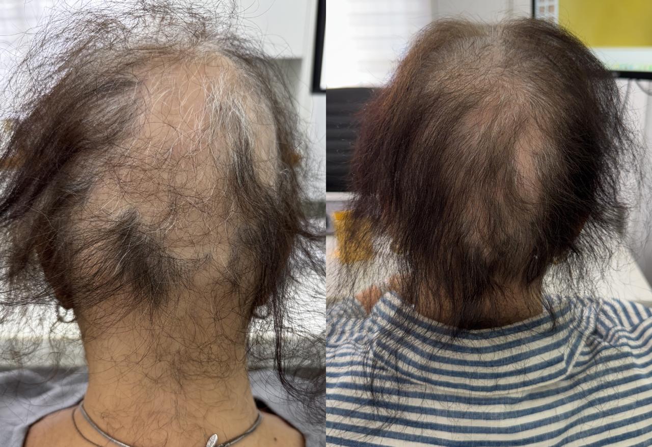 Antes e Depois 7